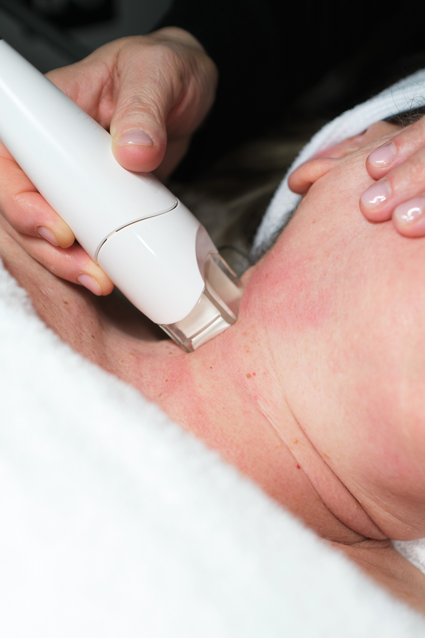 Endermolift LPG ® personalizado DE LUX