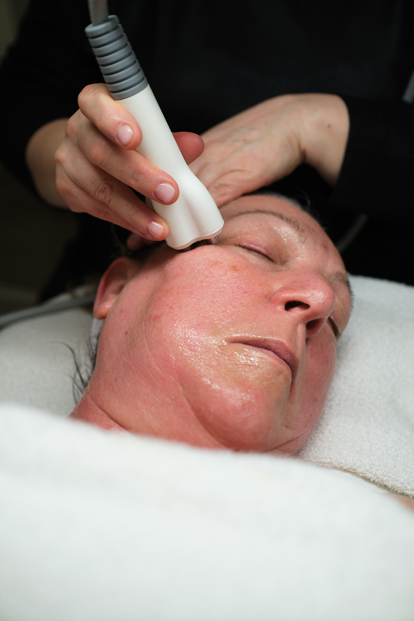 Venus Legacy facial