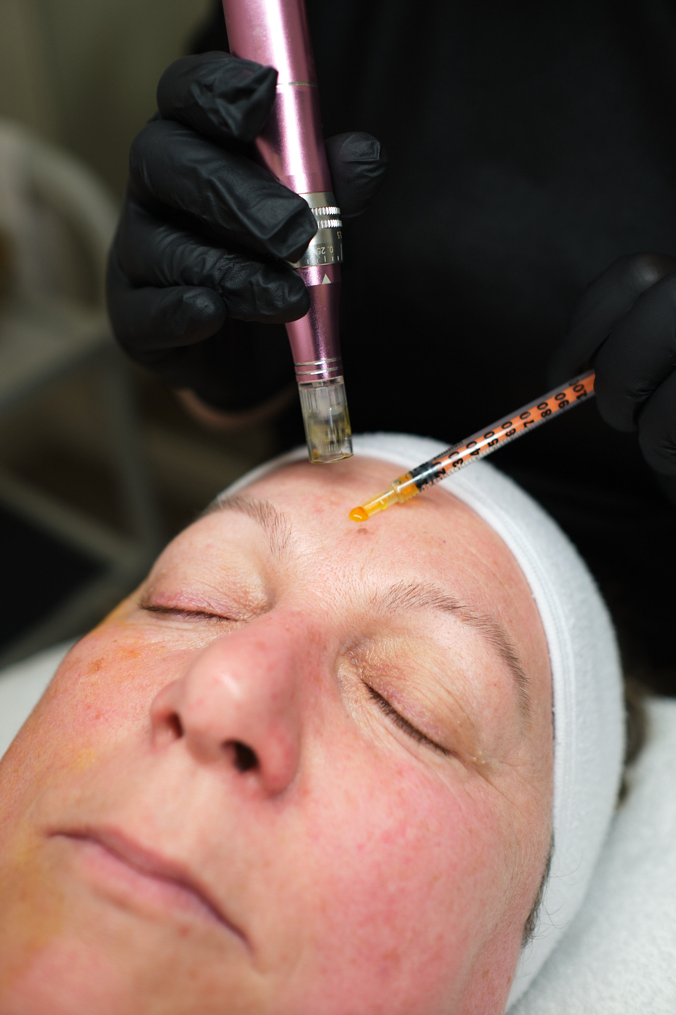 Dermal-Center-Baja-123